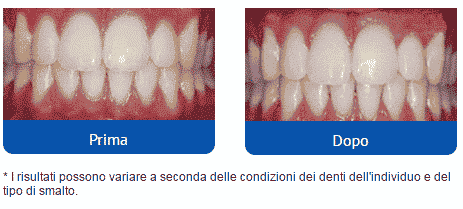 Ionic White™ Come agisce