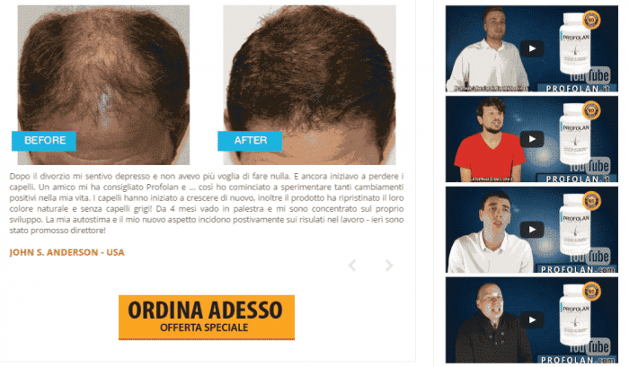 Recensioni commenti pareri Profolan