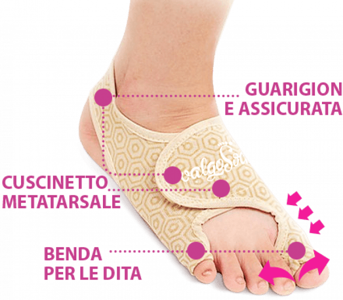 valgosocks funziona