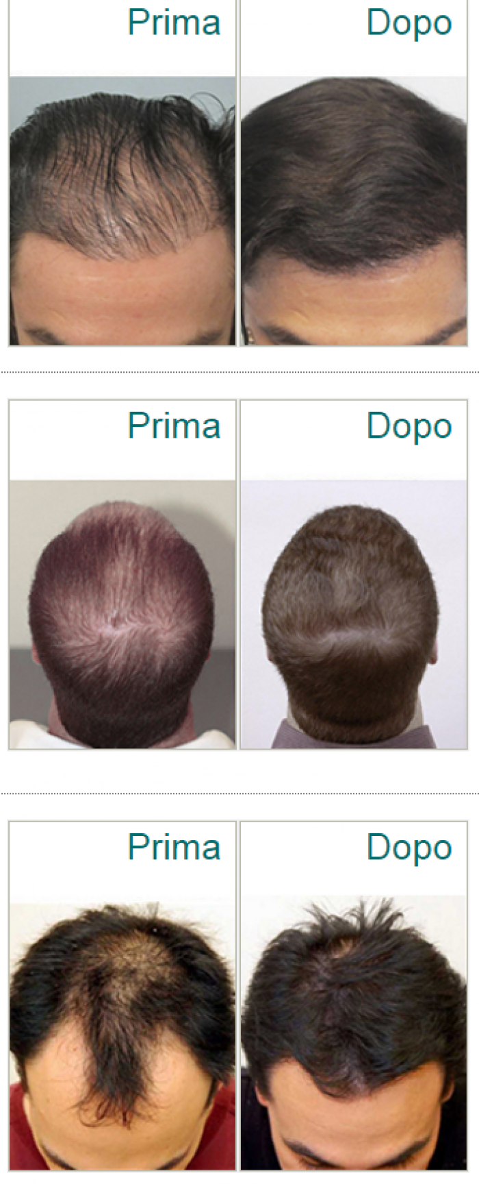 Follixin prima e dopo